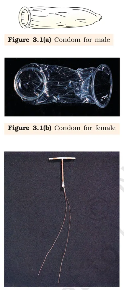 Figure from Reproductive Health